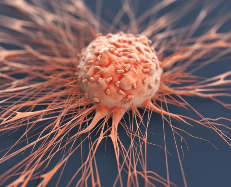 Un nuevo estudio para detectar cáncer de próstata
