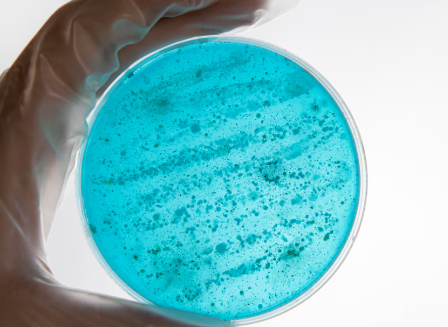 ¿Qué es la salmonelosis y cómo afecta?