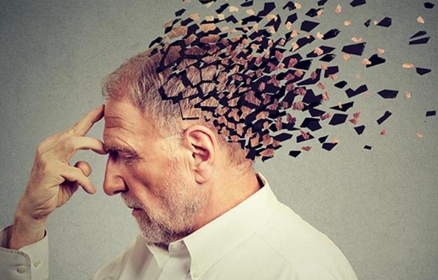 ¿Cómo funciona el "interruptor biológico" del Alzheimer?